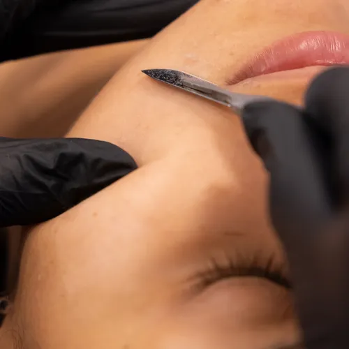 Dermaplaning en Piel Studio Dermaplaning en Piel Studio