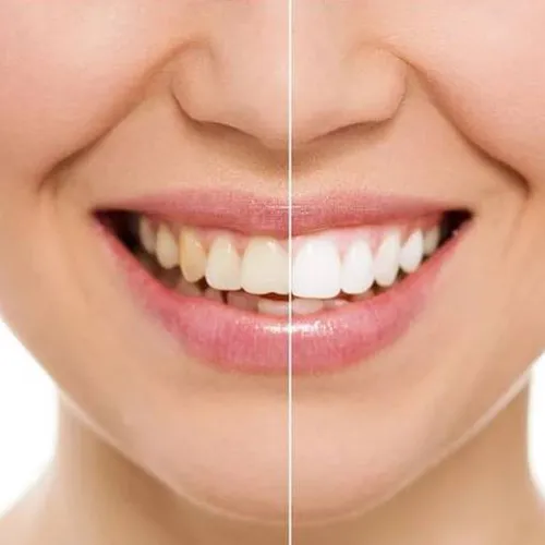 Dental Concept Dental Concept